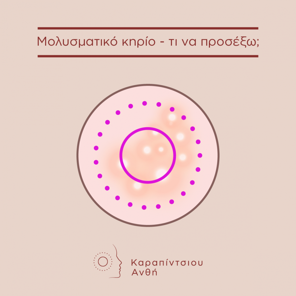 anthi-karapintsiou-dermatologos-molusmatiko-khrio
